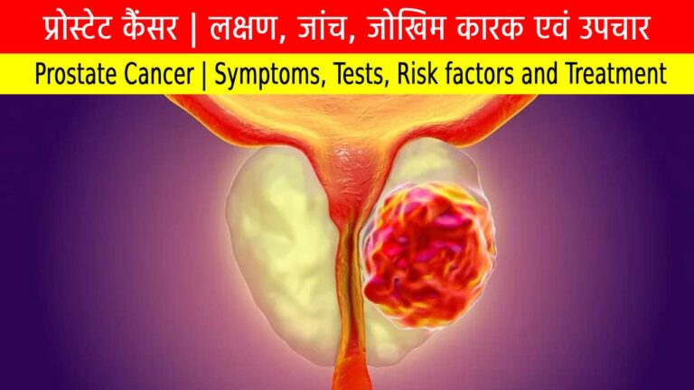 प्रोस्टेट कैंसर
