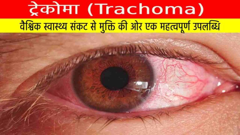 ट्रेकोमा (Trachoma)