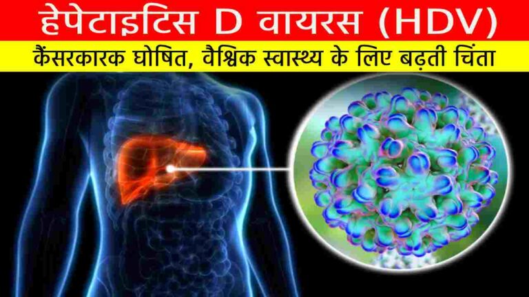 हेपेटाइटिस D वायरस (HDV):