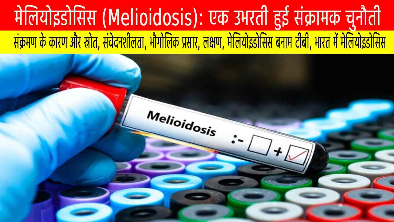 मेलियोइडोसिस (Melioidosis): एक उभरती हुई संक्रामक चुनौती